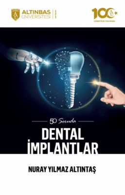 50 Soruda Dental İmplantlar - 1