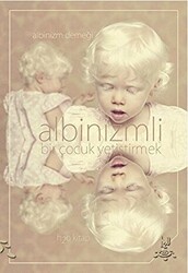 Albinizmli Bir Çocuk Yetiştirmek - 1