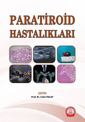 Paratiroid Hastalıkları - 1